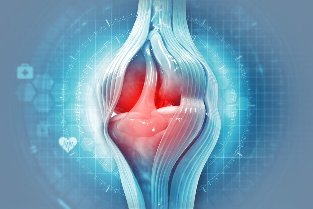 Patient preparing questions and imaging for an orthopedic consultation about knee osteoarthritis