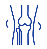Delayed Osteoarthritis Progression
