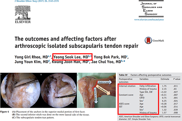 Excerpt from the published paper in the Journal of Shoulder and Elbow Surgery, with the author name highlighted