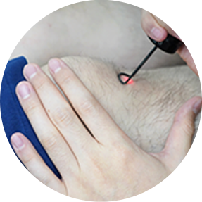Cold pack applied to the knee after treatment
