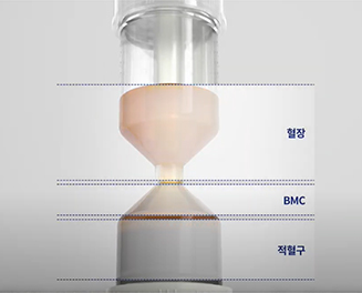 Separated layers in the kit after centrifugation: plasma on top, bone marrow concentrate in the middle, red blood cells below