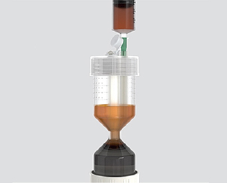 The concentrated bone marrow layer being drawn off
